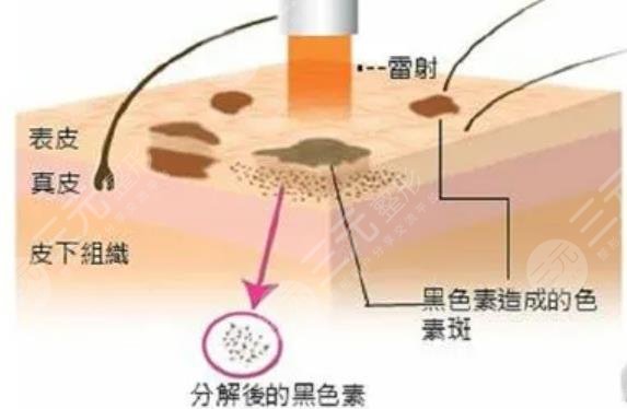 好用的美白保湿面膜有哪些