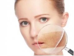 女生皮肤粗糙怎么办？​操作方法有哪些?医美方法解决？