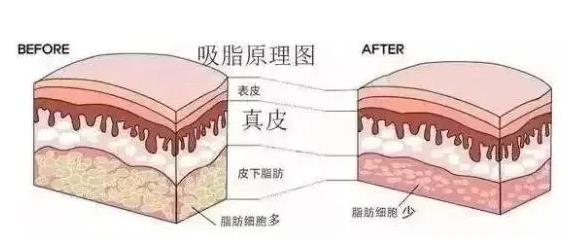 减掉赘肉的方式有哪些呢