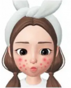 脸部痤疮怎么治疗？激光治疗脸部痤疮有哪些优势？脸部痤疮应该注意哪些问题？