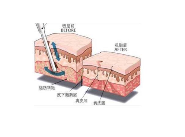 男人健康减肥方法