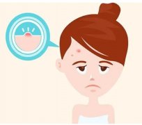 额头上长疙瘩怎么办？这8条建议值得一看！