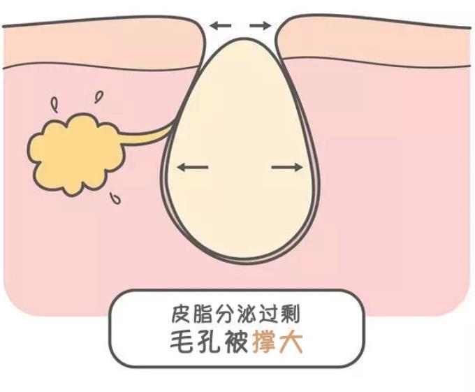 白瓷娃娃美容多少钱