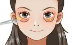 眼袋怎么快速消除?如何护理自己的眼部肌肤?