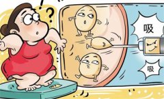 吸脂减肥安全吗？吸脂减肥有哪些优势？术后应该怎样护理？