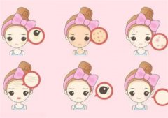 e光祛斑效果怎么样？e光去斑术后注意事项？