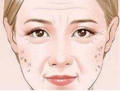 治疗老年斑的偏方有哪些？7种饮食调理减少老年斑！