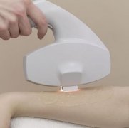 冰点脱毛能永久去除吗？总结这三点冰点脱毛知识！爱美的小仙女不能错过~