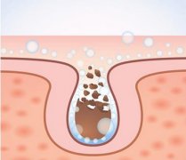 怎么缩小脸部毛孔？隐藏毛孔的秘诀分享~