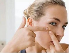 怎样减少青春痘？消除痘痘的5个小妙招！