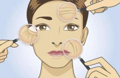 改善法令纹的方法汇总！看完涨知识！