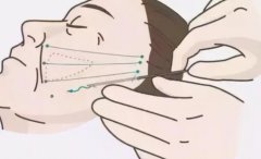 瘦脸手术有哪些？神秘线雕、焕颜除皱针等效果都不错！