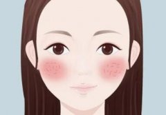 激光能去红血丝吗？可以根治吗？快速修复敏感肌！