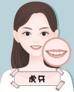 虎牙矫正的好方法有哪些？整齐的牙齿大大提升我们的颜值！快看看吧~