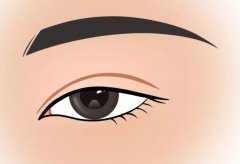 哪几种眼型的人适合做割双眼皮手术？类型有哪些？戳进来了解一下吧