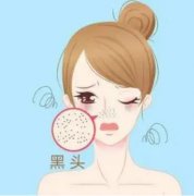 怎样祛黑头粉刺？几招教你摆脱黑头粉刺困扰！