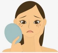 激光美容祛斑副作用有哪些？激光祛斑副作用是什么？答疑篇~