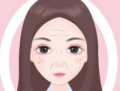 年轻人也会长老年斑吗？一般需要做几次才能去掉？效果可维持多久？