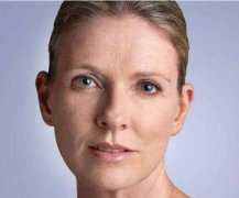 怎样去除脸上的皱纹？除了日常的饮食护肤你还可以这样做！