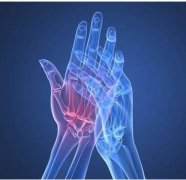 类风湿吃什么食物？吃对食物，减轻一半疼痛！