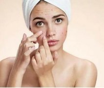 如何减少青春痘？5种减少青春痘的实用方法！摆脱痘痘困扰！