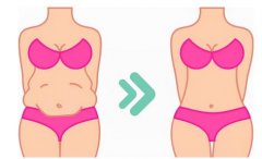 怎样才能减肥？医美减肥安全吗？快速了解~