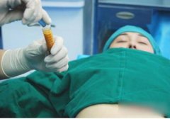 澳洲医生直播隆胸手术 遭同行斥责！关于胸部整形的知识你了解多少？