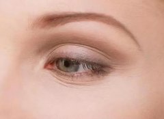 去除眼部细纹小窍门有哪些？盘点5个小窍门！肯定能用得到！