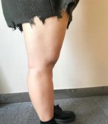 怎样瘦大象腿？6个小技巧帮你变成纤细漫画腿~