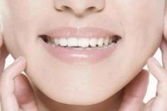 四环素牙如何美白？让牙齿洁白亮丽方法分享！