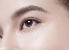 眼袋怎么快速消除？8招轻松搞定！还你美貌！