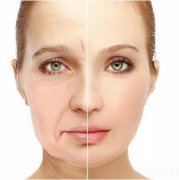 脸部肌肉松弛怎么办？5招帮你恢复美貌！快学起来！