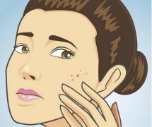 脸上如何祛痘？这几种办法实用有效！网友力推！