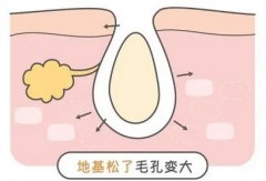 怎么收缩脸上的毛孔？3个小技巧解决毛孔粗大问题！