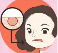 毛孔粗大是什么原因造成的？这几个原因一定不能忽视！