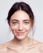 玻尿酸注射的价格贵吗？影响玻尿酸价格因素大总结！