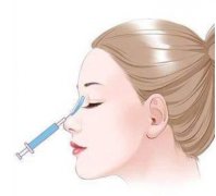 鼻梁打玻尿酸副作用有哪些？这些注意事项不能错过！