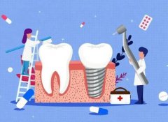 种植满口牙大概需要多少钱？附种植牙以后注意事项！