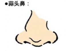 蒜头鼻怎么办？怎么让蒜头鼻彻底消失！
