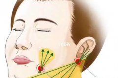 面部吸脂瘦脸怎么样？附有价格、注意事项的分享！