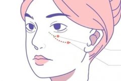 泪沟填充可以维持多久？附有详细的分享以及填充方法！