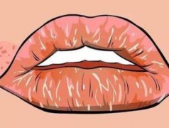 秋冬嘴唇干裂原因是什么？如何缓解这种情况？