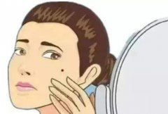 激光点痣好吗？祛痣后有哪些注意事项？术后怎么护理