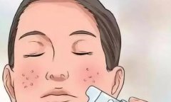 微针可以收缩毛孔吗？有什么注意事项吗？