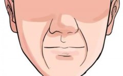 法令纹怎么消除？注射填充和拉皮那种方式比较好？