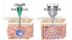 抗衰老精华怎么用？正确的使用方法有哪些？