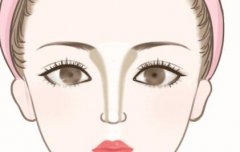 隆鼻修复有哪些方法？玻尿酸隆鼻、假体隆鼻都值得推荐！