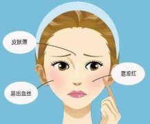 激光去红血丝价格是多少？激光去红血丝作用怎么样？