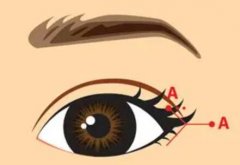 双眼皮可以开眼角吗？下面就有详细的分享~