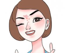 激光祛痘收费标准是什么？激光祛痘大概要多少钱一次？